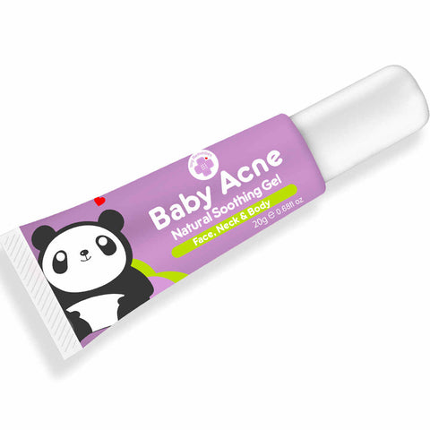 Tiny Buds™ Tiny Remedies Baby Acne Natural Soothing Gel 20g